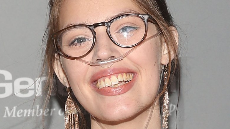 Claire Wineland Death, Bio, Wiki, YouTube, Family, Parents, Age